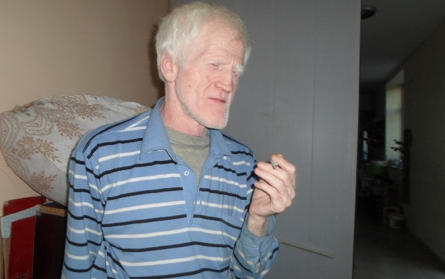 “Fosforlu adamlar”ın SİRLƏRİ - Azərbaycanlı albinos: “Doğulanda anam məndən imtina edib”   