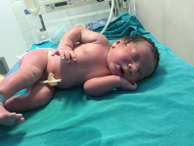 Azərbaycanda yenidoğulmuş appendisitdən əməliyyat olundu - FOTO