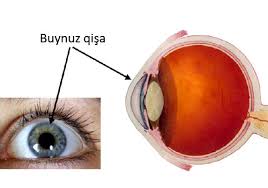 Gözün buynuz qişasının dövriyyəsi üçün tələb olunan şərtlər və sənədlər 