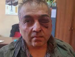 Ermənistanda banka hücum edən polis polkovniki çıxdı - VİDEO