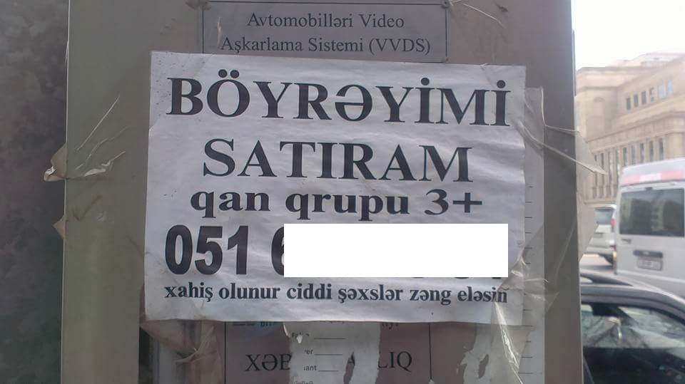 Böyrəyini satmaq istəyən azərbaycanlılar...   