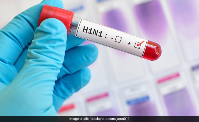 Baş epidemioloq Azərbaycanda 16 nəfərin A/H1N1 virusuna yoluxduğunu TƏSDİQLƏDİ