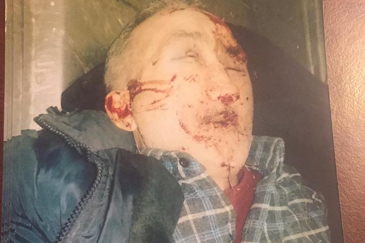 Maşının vurub &ouml;ld&uuml;rd&uuml;y&uuml; piyadanın yaxınları axtarılır - FOTO