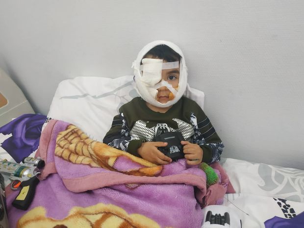 Üzünü it parçalayan uşaqla bağlı yenilik