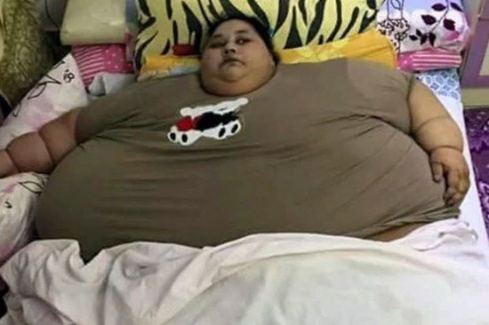 Bakıda ağırçəkili şəxs çarpayıdan yıxıldı, FHN-i köməyə çağırdılar