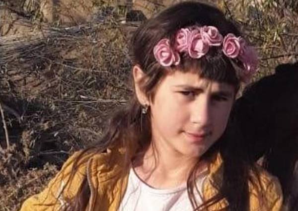 Dövlət Komitəsi yandırılan 10 yaşlı qızın məsələsini nəzarətə GÖTÜRDÜ