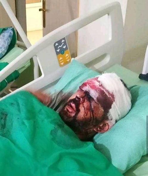 Azərbaycanlı müğənni ağır qəzaya düşdü, tanınmaz haldadır - FOTO