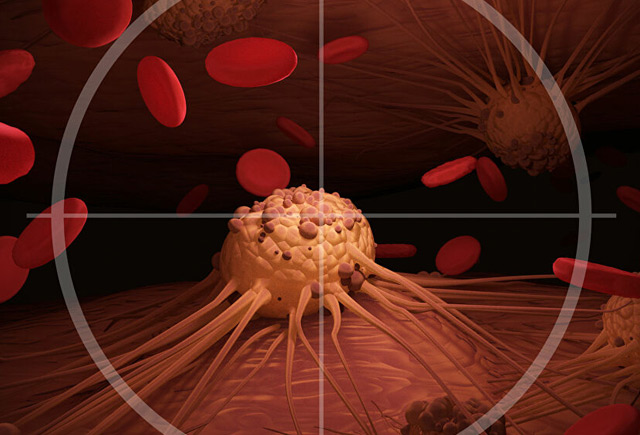 Hansı qan qrupu hansı xərçəng növünün riskini artırır?