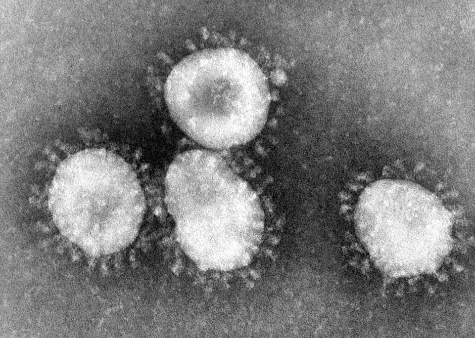 ABŞ-da dəhşətli virus aşkarlandı