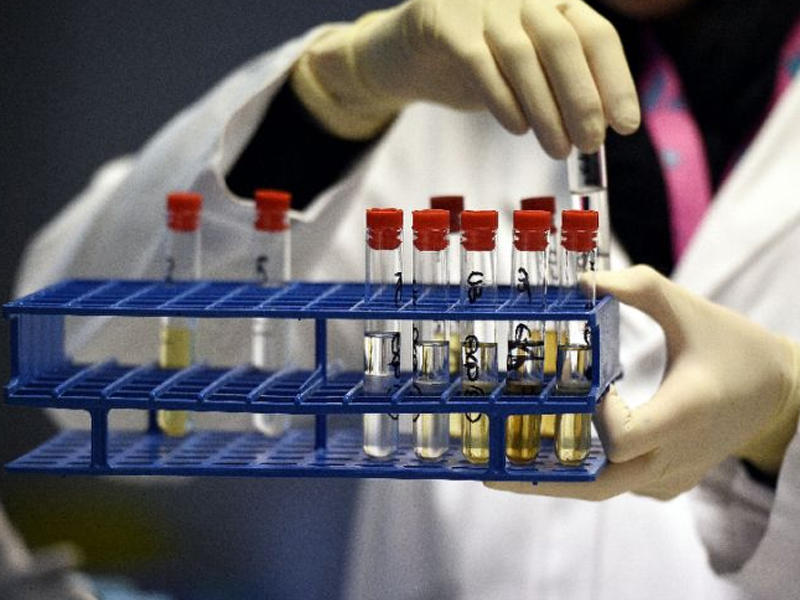 Azərbaycanın daha 4 idmançısında dopinq aşkarlandı