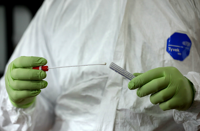 Dünyanın 102 ölkəsində koronavirus tapılıb