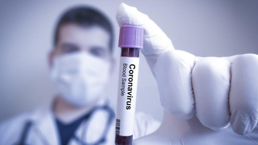 Çin koronavirusa görə dünyaya maddi təzminat ödəyəcəkmi? - TƏHLİL