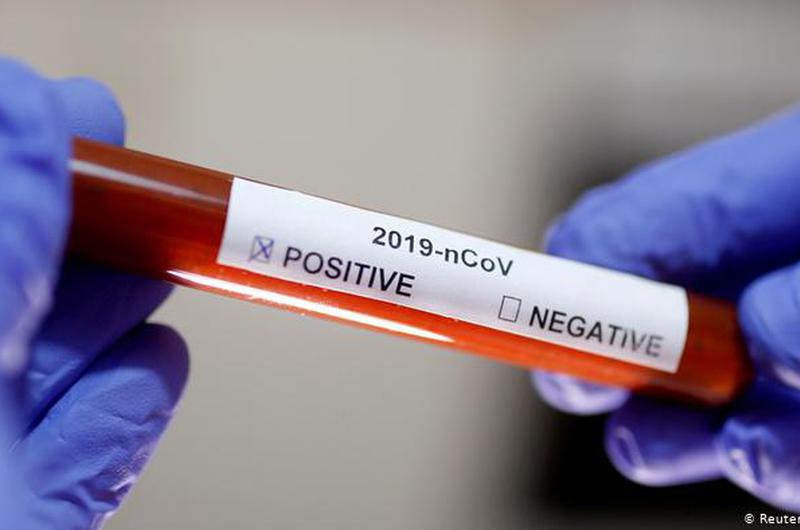 Koronavirus testi verən 11 dövlət başçısı - Onlardan 2-si virusa YOLUXUB