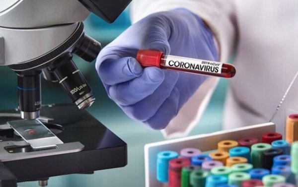 Azərbaycanda daha 3656 nəfər koronavirusla bağlı test olundu