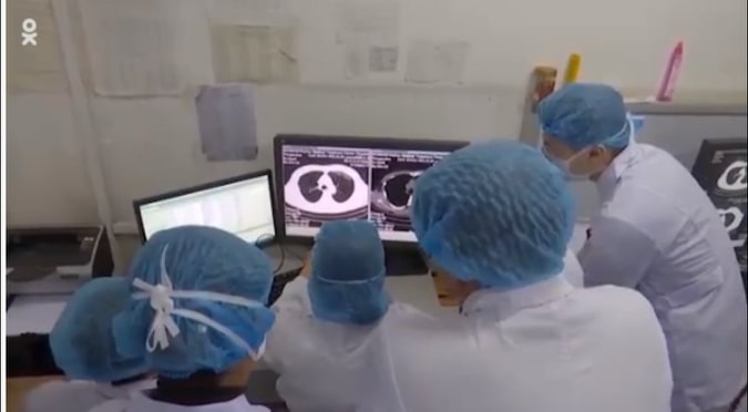 Koronavirusun yeni dermatoloji əlaməti aşkarlandı