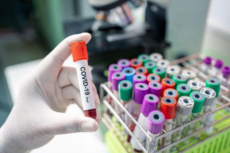 Koronavirusla bağlı testlər həmişə etibarlı deyil - Almaniyalı professor