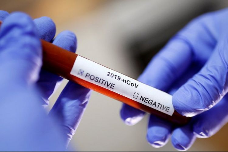 Belçikada 5683 nəfər koronavirusdan ölüb