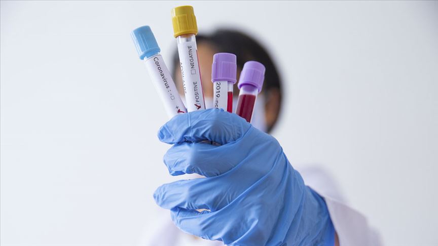 Koronavirus testindən necə keçmək olar? - TƏBİB-dən AÇIQLAMA 