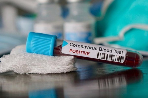 Dünyada koronavirusa yoluxanların sayı 2,7 milyonu ötdü