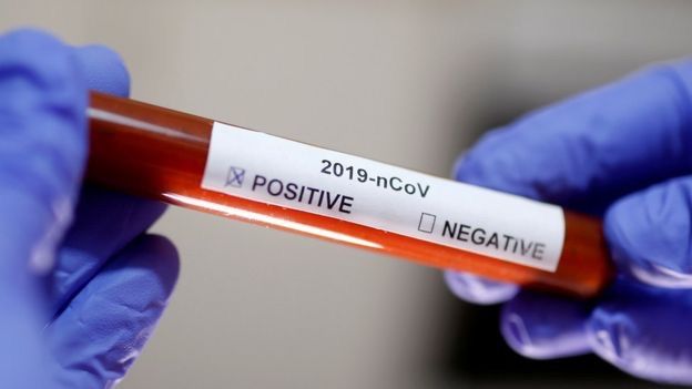 “Hər kəs bilsin ki, bu il koronavirus yox olmayacaq” - RƏSMİ
