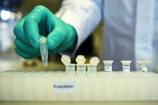 Azərbaycanda koronavirus XƏBƏRDARLIĞI: Vəziyyət çox gərginləşə bilər - VİDEO