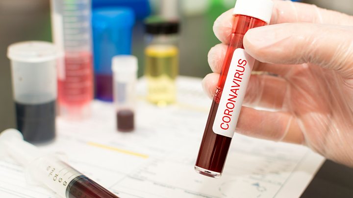 “Koronavirus insan əli ilə yaradılmayıb” – YEKUN RƏY