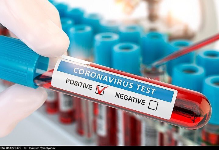 Azərbaycanda 197545  nəfər koronavirus testindən keçib