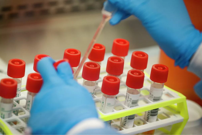 Ölkədə koronavirusla bağlı testlərin sayı açıqlandı - RƏSMİ