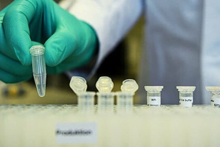 İranda bir gündə 2364 nәfәr virusa yoluxdu - 72 ölü