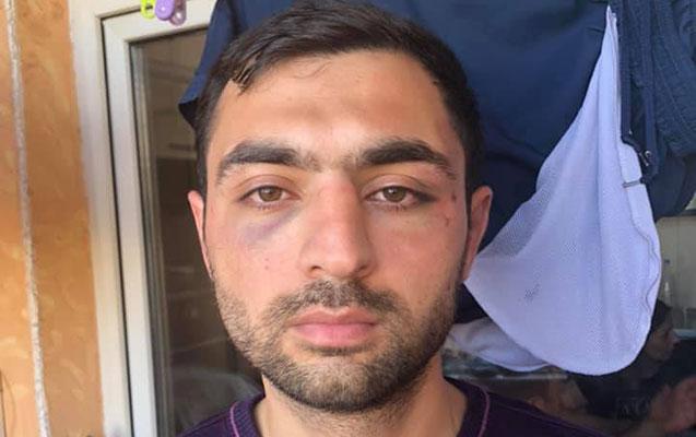 Polis Kərim Süleymanlının döyülməsini TƏKZİB ETDİ