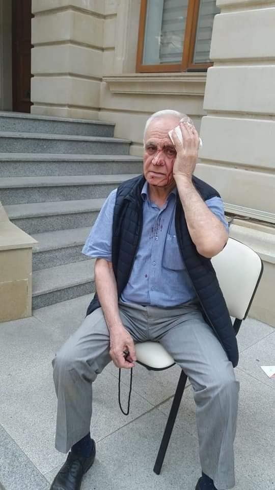 Rəhim Qazıyevi küçədə döydülər - FOTOLAR