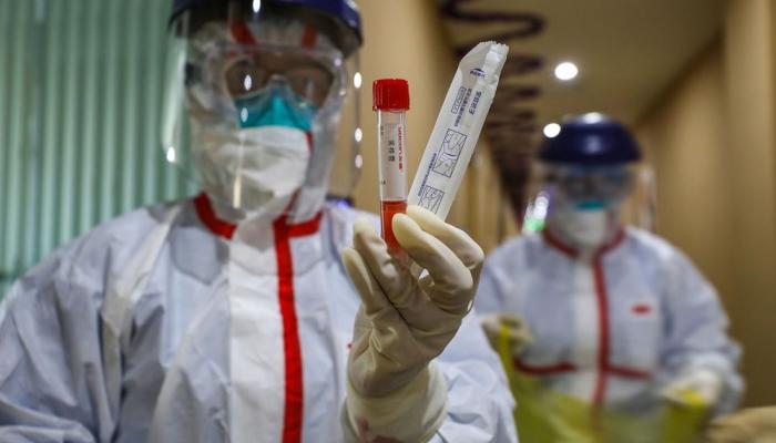 ÜST dünyada koronavirusla bağlı son vəziyyəti AÇIQLADI