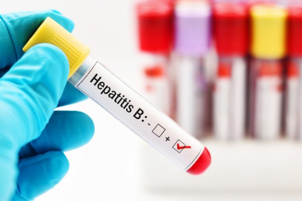 Azərbaycanda ötən il viruslu hepatit xəstəliyindən ölənlərin sayı AÇIQLANDI