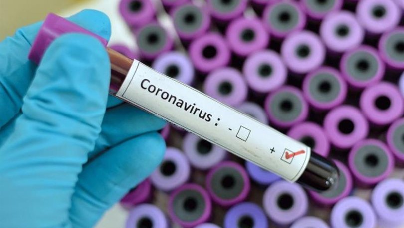 Türkiyədəki vətəndaşlarımız pulsuz koronavirus testindən KEÇƏCƏKLƏR