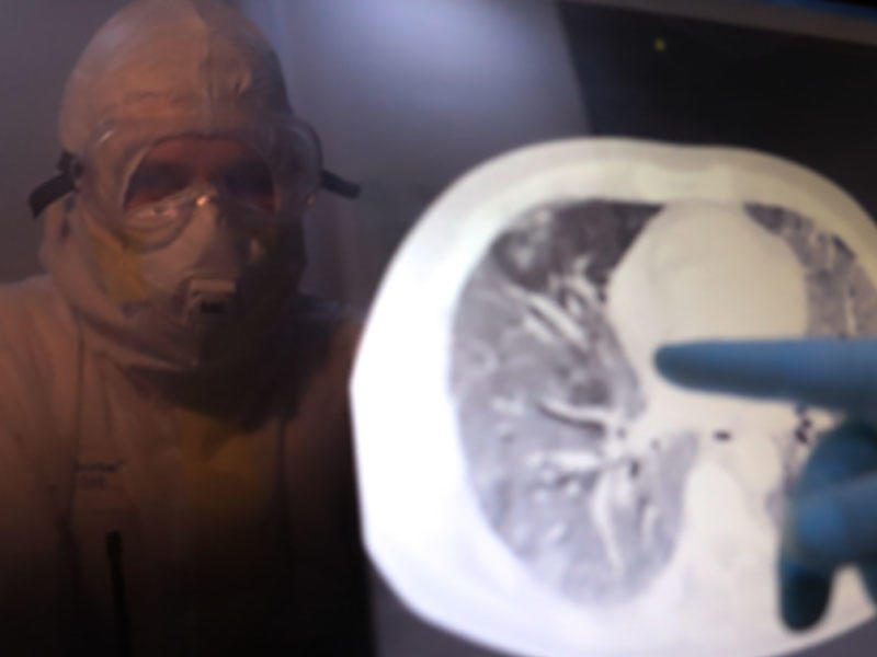 Zədələnmiş ağciyərin müalicəsində ƏN SON ÜSUL