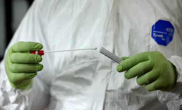 Azərbaycanda neçə koronavirus testi keçirilib?