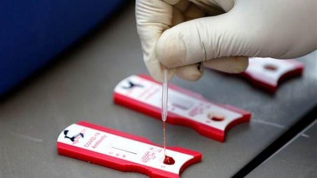 Koronavirusun 2-ci dalğasının yayılacağı 10 ölkənin adı açıqlandı - SİYAHI