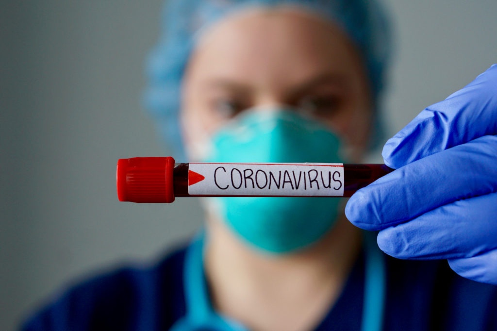 Azərbaycanda daha 588 nəfər koronavirusa yoluxdu, 7 nəfər öldü