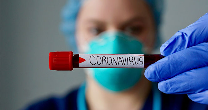 Azərbaycanda koronavirusdan ölüm 2 faiz təşkil edir  
