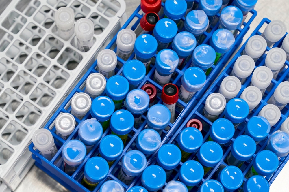 ÜST daha bir preparatın kliniki testlərini dayandırıb   