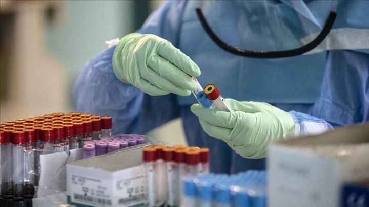 Rusiyada koronavirus üçün peyvəndin ilk sınağı başa çatdı  