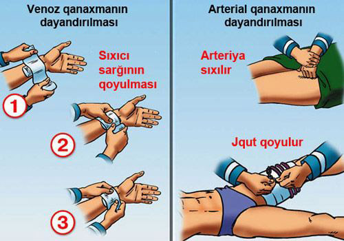 QANAXMALARI NECƏ DAYANDIRMAQ OLAR?