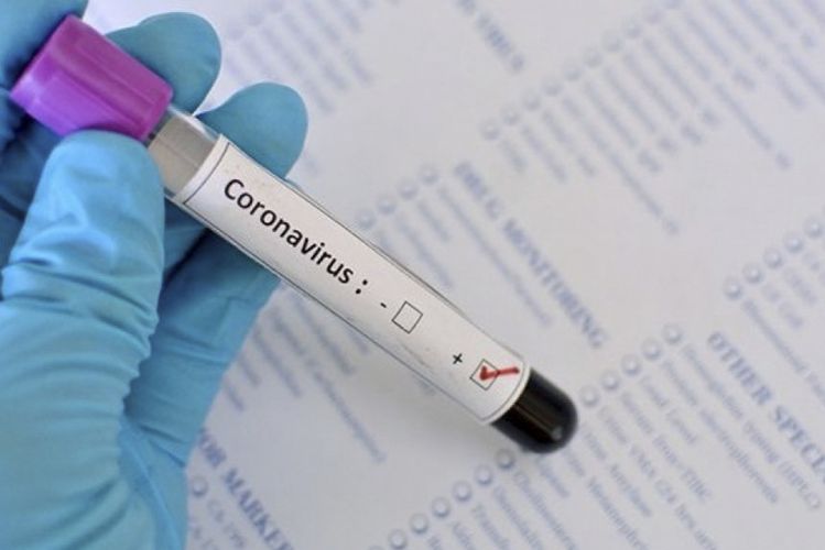 ABŞ-da son sutkada koronavirusdan 930 nəfər öldü