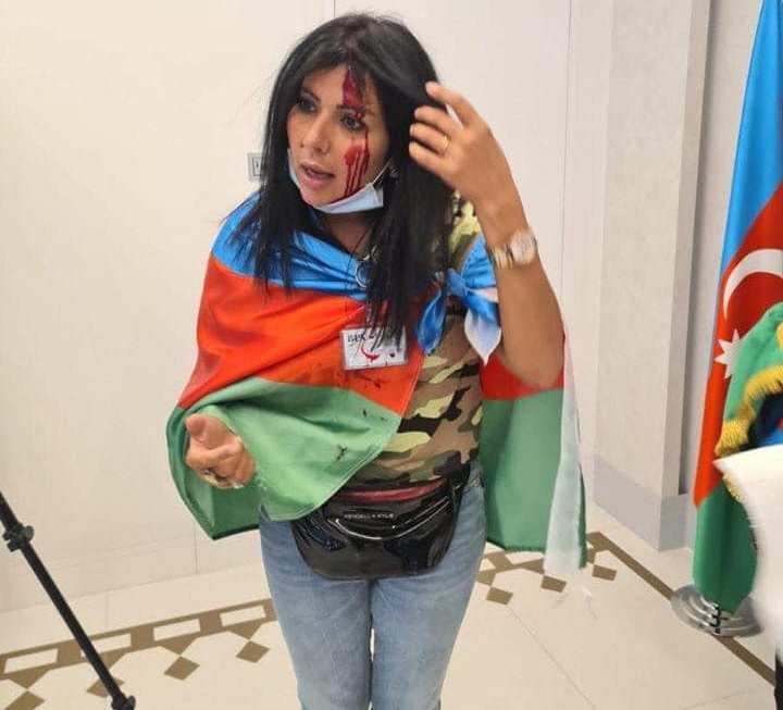 Ermənilər Hollandiyada azərbaycanlı jurnalistə xəsarət yetirdi – FOTO