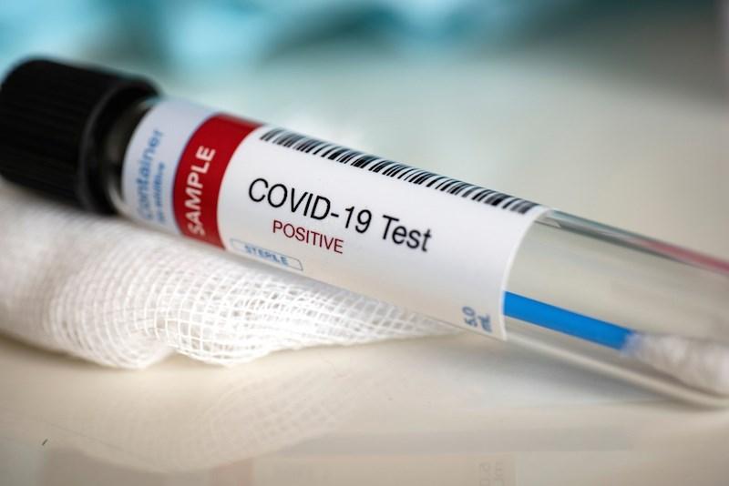 Yaponiyada koronavirusa rekord yoluxma