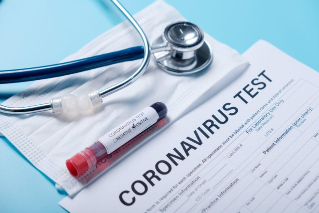 TƏBİB koronavirus testindən keçmək üçün vətəndaşlara zəng vurur 