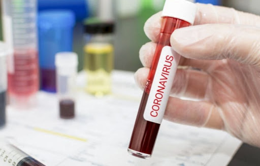 Koronavirusa yoluxan 79 nəfər donor olub