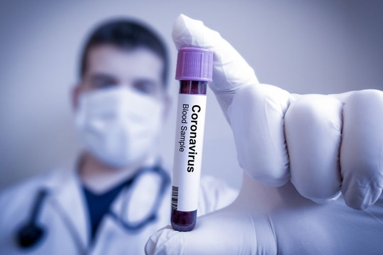 Rusiyada koronavirusa yoluxanların sayı açıqlandı
