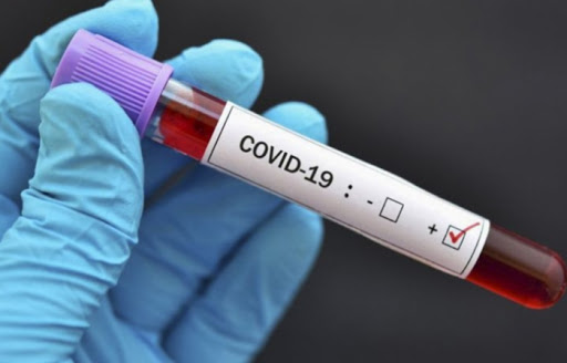 Dünyada koronavirusdan ölənlərin sayı 879 min nəfəri ötdü  