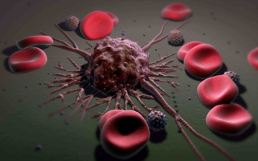 Alimlər xərçəng xəstəliyinin metastazına üstün gəlmək üsulunu tapdılar